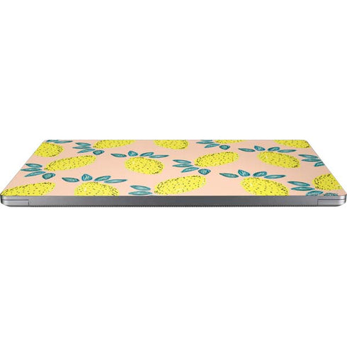 Bouffants and Broken Hearts Lemon Party Universal Laptop 15in (12.2 x 8.8in) Skin